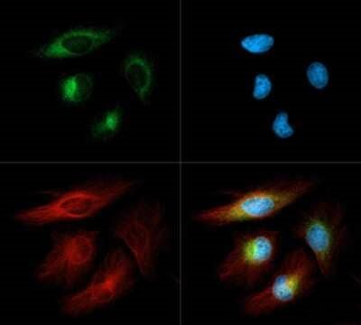 DERL1 Antibody in Immunocytochemistry (ICC/IF)