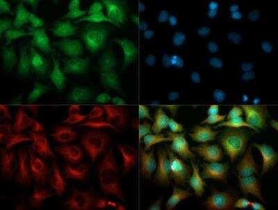 VEGF Receptor 1/2 Antibody in Immunocytochemistry (ICC/IF)