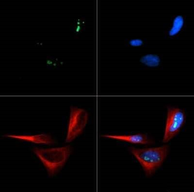 p14ARF Antibody in Immunocytochemistry (ICC/IF)