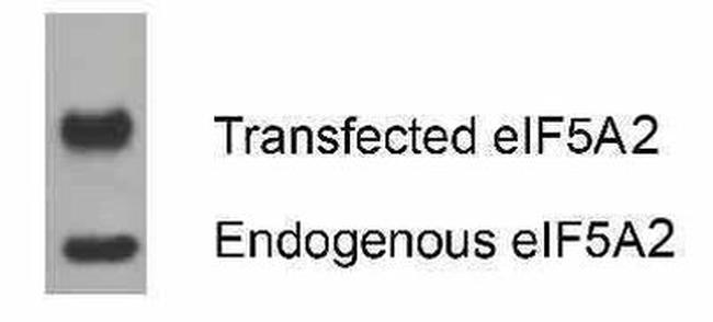 eIF5A2 Antibody in Western Blot (WB)