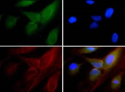 15-PGDH Antibody in Immunocytochemistry (ICC/IF)
