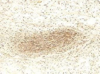 MMP2 Antibody in Immunohistochemistry (IHC)
