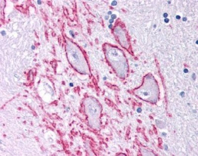 TACR1 Antibody in Immunohistochemistry (IHC)