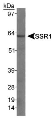 SSTR1 Antibody in Western Blot (WB)