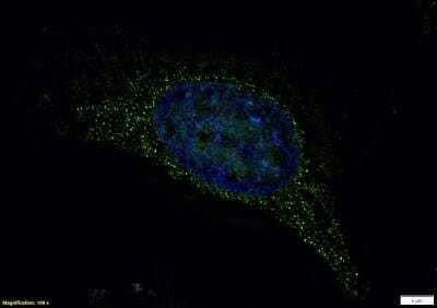 LRRK2 Antibody in Immunocytochemistry (ICC/IF)