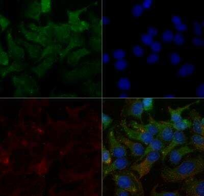 SR-BI Antibody in Immunocytochemistry (ICC/IF)