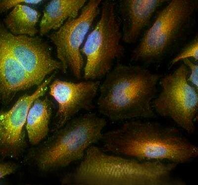 ABCE1 Antibody in Immunocytochemistry (ICC/IF)