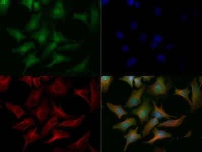 ChREBP Antibody in Immunocytochemistry (ICC/IF)
