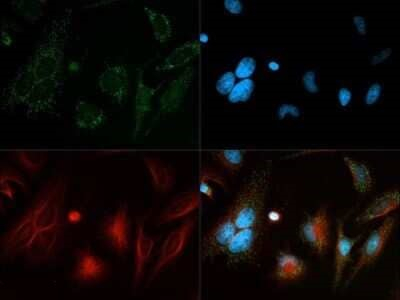 Beclin 1 Antibody in Immunocytochemistry (ICC/IF)