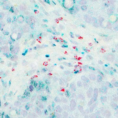 FOXP3 Antibody in Immunohistochemistry (Paraffin) (IHC (P))