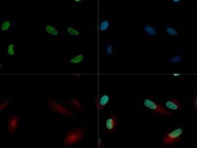 JARID2 Antibody in Immunocytochemistry (ICC/IF)