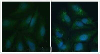 LC3A/LC3B Antibody in Immunocytochemistry (ICC/IF)