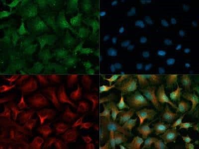 PHD2 Antibody in Immunocytochemistry (ICC/IF)