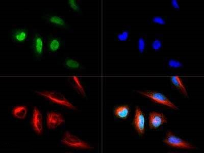 LOX Antibody in Immunocytochemistry (ICC/IF)
