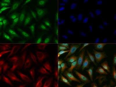 LOX Antibody in Immunocytochemistry (ICC/IF)