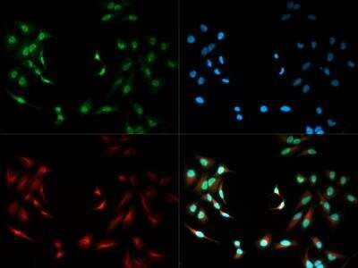 SIRT6 Antibody in Immunocytochemistry (ICC/IF)
