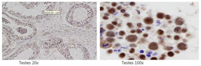 SIRT6 Antibody in Immunohistochemistry (IHC)