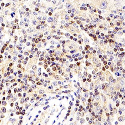 SPDYA Antibody in Immunohistochemistry (Paraffin) (IHC (P))