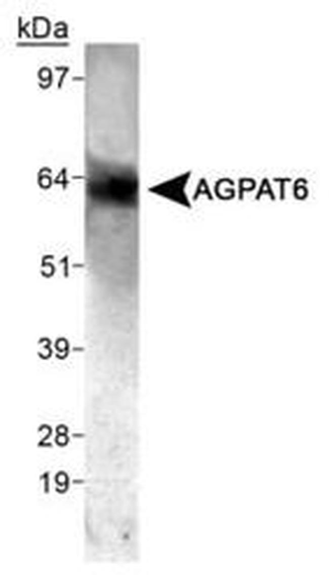 AGPAT6 Antibody in Western Blot (WB)