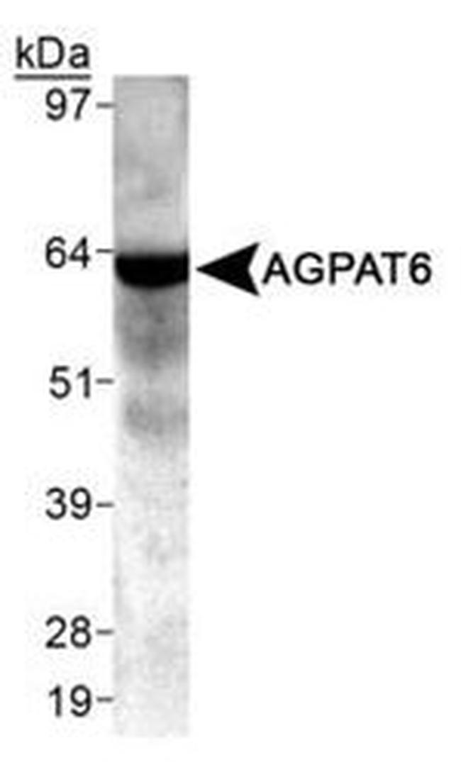 AGPAT6 Antibody in Western Blot (WB)