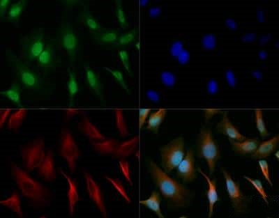 SOX2 Antibody in Immunocytochemistry (ICC/IF)