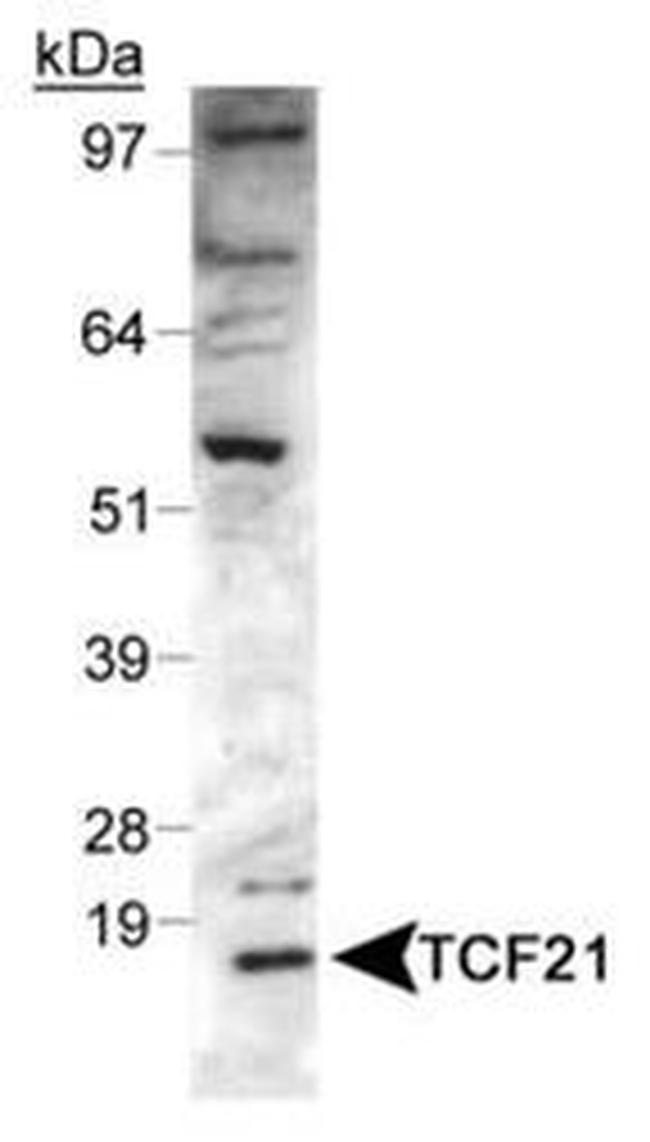 TCF21 Antibody in Western Blot (WB)