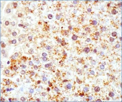 ADFP Antibody in Immunohistochemistry (Paraffin) (IHC (P))