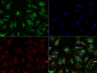 ADFP Antibody in Immunocytochemistry (ICC/IF)