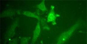 BMI-1 Antibody in Immunocytochemistry (ICC/IF)