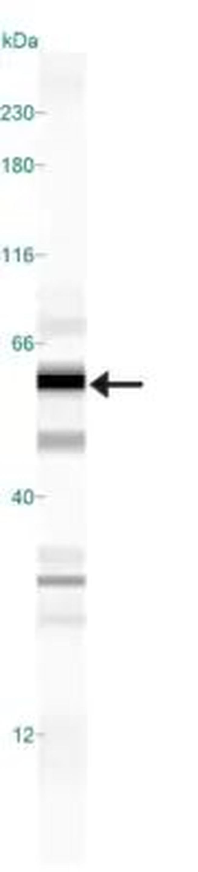 ATP13A2 Antibody in Western Blot (WB)