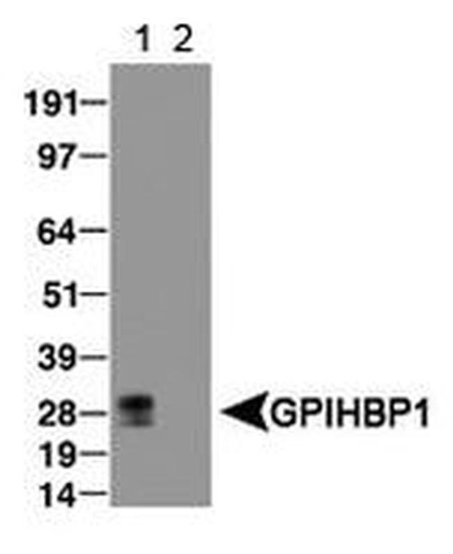 GPIHBP1 Antibody in Western Blot (WB)