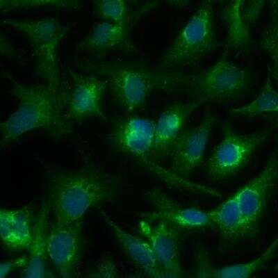 DGAT1 Antibody in Immunocytochemistry (ICC/IF)