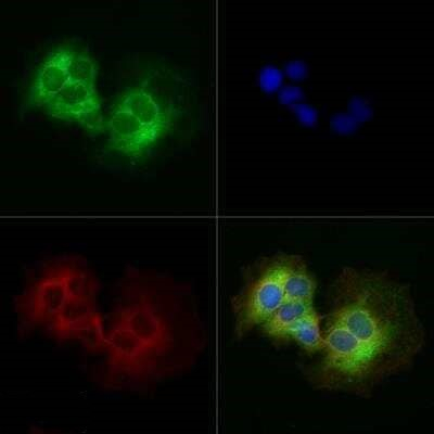 DNM1L Antibody in Immunocytochemistry (ICC/IF)