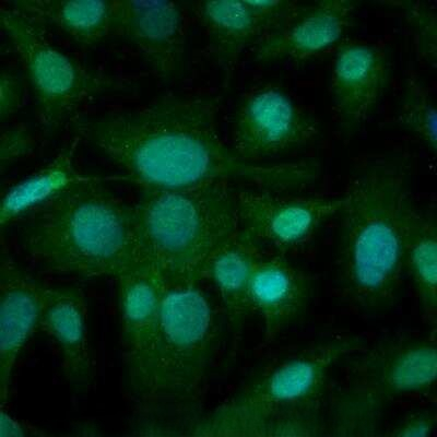 LOX Antibody in Immunocytochemistry (ICC/IF)