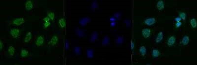 TDP-43 Antibody in Immunocytochemistry (ICC/IF)