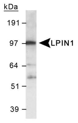 LPIN1 Antibody in Western Blot (WB)
