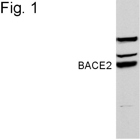 BACE2 Antibody in Western Blot (WB)