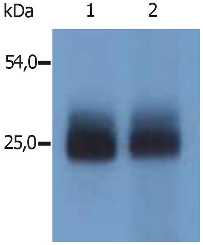 NTAL Antibody in Western Blot (WB)
