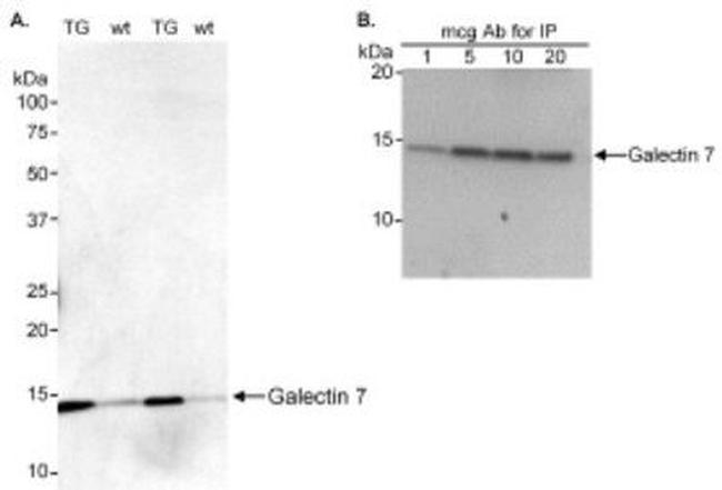 Galectin 7 Antibody in Western Blot (WB)