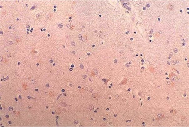 BACE1 Antibody in Immunohistochemistry (Paraffin) (IHC (P))
