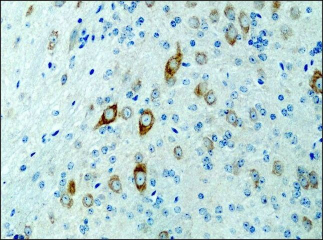 KIF3A Antibody in Immunohistochemistry (Paraffin) (IHC (P))