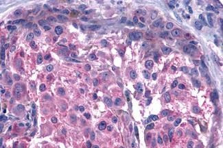 GPR15 Antibody in Immunohistochemistry (Paraffin) (IHC (P))