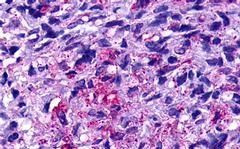 GPR19 Antibody in Immunohistochemistry (Paraffin) (IHC (P))