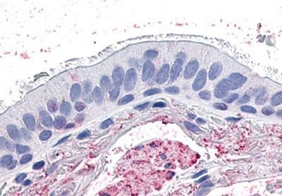 GPR4 Antibody in Immunohistochemistry (Paraffin) (IHC (P))