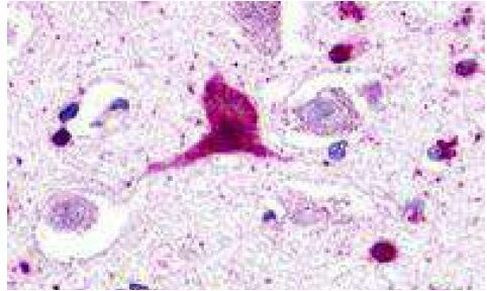 GPR62 Antibody in Immunohistochemistry (Paraffin) (IHC (P))