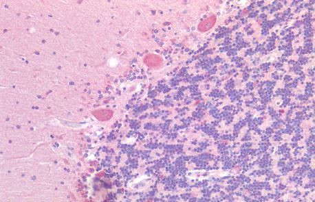 GPR87 Antibody in Immunohistochemistry (Paraffin) (IHC (P))