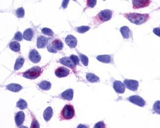 GPR137B Antibody in Immunocytochemistry (ICC/IF)