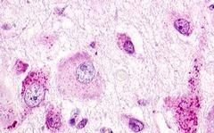 GPR22 Antibody in Immunohistochemistry (Paraffin) (IHC (P))