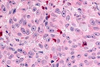 MRGPRX1 Antibody in Immunohistochemistry (Paraffin) (IHC (P))