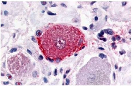 MRGPRX2 Antibody in Immunohistochemistry (Paraffin) (IHC (P))